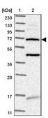 Anti-TMEM87B antibody produced in rabbit Prestige Antibodies&#174; Powered by Atlas Antibodies, affinity isolated antibody, buffered aqueous glycerol solution