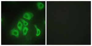 Anti-TNFA antibody produced in rabbit affinity isolated antibody