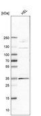 Anti-ELOVL7 antibody produced in rabbit Prestige Antibodies&#174; Powered by Atlas Antibodies, affinity isolated antibody, buffered aqueous glycerol solution