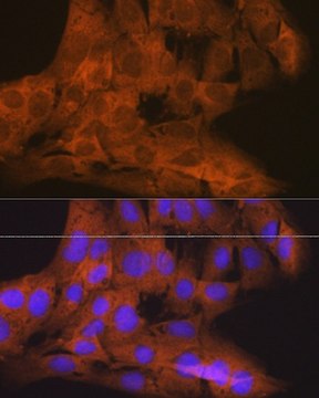 Anti-TBK1/NAK antibody produced in rabbit