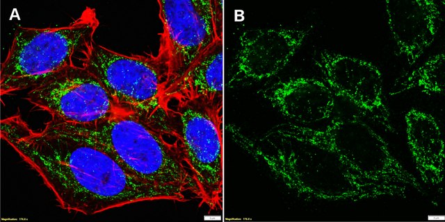 Anti-FIS1 Antibody, clone 1C7 ZooMAb&#174; Rabbit Monoclonal recombinant, expressed in HEK 293 cells