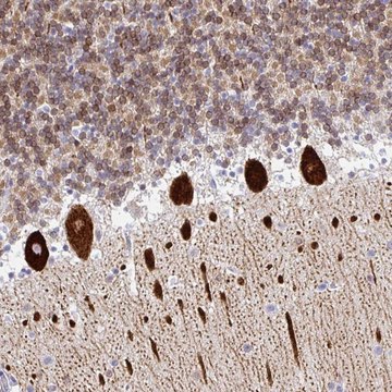 Anti-TP53I11 antibody produced in rabbit Prestige Antibodies&#174; Powered by Atlas Antibodies, affinity isolated antibody, buffered aqueous glycerol solution