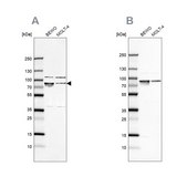 Anti-HSPA5 antibody produced in rabbit Prestige Antibodies&#174; Powered by Atlas Antibodies, affinity isolated antibody, buffered aqueous glycerol solution