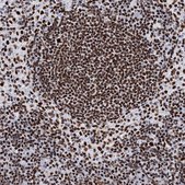 Anti-MATR3 antibody produced in rabbit Prestige Antibodies&#174; Powered by Atlas Antibodies, affinity isolated antibody, buffered aqueous glycerol solution