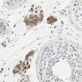 Anti-ETNK1 antibody produced in rabbit Prestige Antibodies&#174; Powered by Atlas Antibodies, affinity isolated antibody, buffered aqueous glycerol solution