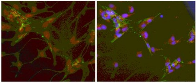 Anti-Fibroblast-specific Protein 1 (S100A4) Antibody from rabbit, purified by affinity chromatography