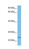 Anti-SLC25A14 antibody produced in rabbit IgG fraction of antiserum