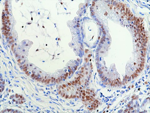 Anti-RNASEH2B Rabbit Monoclonal Antibody affinity purified immunoglobulin