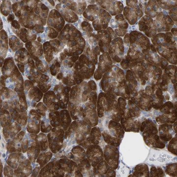 Anti-UBE4B antibody produced in rabbit Prestige Antibodies&#174; Powered by Atlas Antibodies, affinity isolated antibody, buffered aqueous glycerol solution