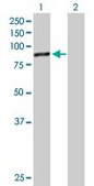 Anti-DDX18 antibody produced in mouse purified immunoglobulin, buffered aqueous solution