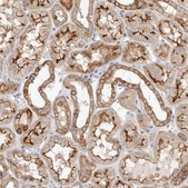 Anti-USH1C antibody produced in rabbit Prestige Antibodies&#174; Powered by Atlas Antibodies, affinity isolated antibody, buffered aqueous glycerol solution, ab3