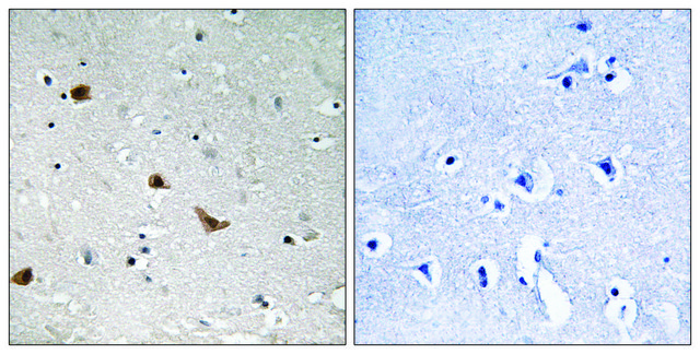 Anti-phospho-IKK-&#947; (pSer376) antibody produced in rabbit affinity isolated antibody