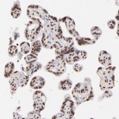 Anti-INTS6 antibody produced in rabbit Prestige Antibodies&#174; Powered by Atlas Antibodies, affinity isolated antibody, buffered aqueous glycerol solution