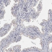 Anti-PLIN1 antibody produced in rabbit Prestige Antibodies&#174; Powered by Atlas Antibodies, affinity isolated antibody, buffered aqueous glycerol solution