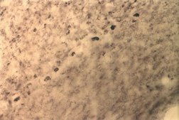 Anti-Potassium Channel Kv1.1 Antibody Chemicon&#174;, from rabbit