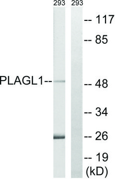 Anti-PLAGL1 antibody produced in rabbit affinity isolated antibody