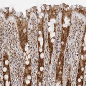Anti-WDR77 antibody produced in rabbit Prestige Antibodies&#174; Powered by Atlas Antibodies, affinity isolated antibody, buffered aqueous glycerol solution, ab3