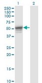Monoclonal Anti-KRT13 antibody produced in mouse clone 4F5, purified immunoglobulin, buffered aqueous solution