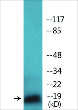 Anti-phospho-TEBP (pSer113) antibody produced in rabbit affinity isolated antibody