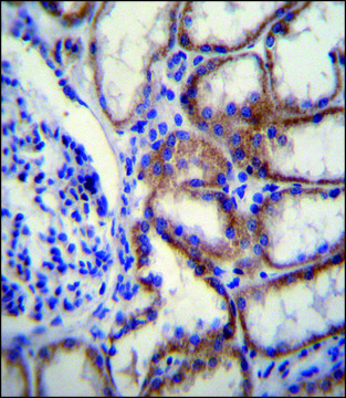 ANTI-COL8A2 (C-TERM) antibody produced in rabbit IgG fraction of antiserum, buffered aqueous solution
