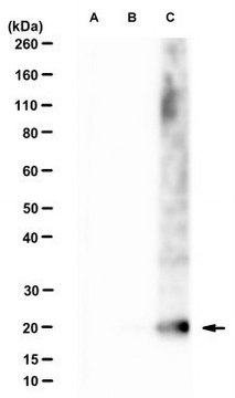 Anti-CMTM6 Antibody, clone RCT6