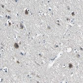 Anti-SLC16A7 antibody produced in rabbit Prestige Antibodies&#174; Powered by Atlas Antibodies, affinity isolated antibody, buffered aqueous glycerol solution