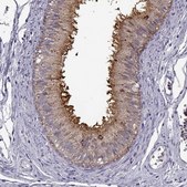 Anti-ADGRG2 antibody produced in rabbit Prestige Antibodies&#174; Powered by Atlas Antibodies, affinity isolated antibody, buffered aqueous glycerol solution