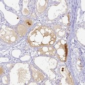 Anti-LTF antibody produced in rabbit Prestige Antibodies&#174; Powered by Atlas Antibodies, affinity isolated antibody, buffered aqueous glycerol solution