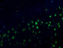 Anti-Alzheimer Precursor Protein A4 Antibody, clone 22C11, Alexa488 Conj. clone 22C11, from mouse, ALEXA FLUOR&#8482; 488