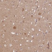 Anti-PDE6D antibody produced in rabbit Prestige Antibodies&#174; Powered by Atlas Antibodies, affinity isolated antibody, buffered aqueous glycerol solution
