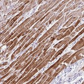 Anti-NDUFS2 antibody produced in rabbit Prestige Antibodies&#174; Powered by Atlas Antibodies, affinity isolated antibody, buffered aqueous glycerol solution
