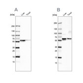 Anti-SERPINA1 antibody produced in rabbit Prestige Antibodies&#174; Powered by Atlas Antibodies, affinity isolated antibody, buffered aqueous glycerol solution