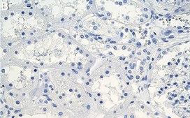 Anti-Spectrin &#945; Antibody, clone 1D4 ZooMAb&#174; Rabbit Monoclonal recombinant, expressed in HEK 293 cells
