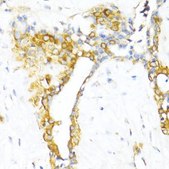 Anti-CTGF antibody produced in rabbit