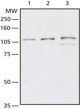 Anti-O-GlcNAc Transferase (DM-17) antibody produced in rabbit affinity isolated antibody, buffered aqueous solution