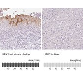 Anti-UPK2 antibody produced in rabbit Prestige Antibodies&#174; Powered by Atlas Antibodies, affinity isolated antibody, buffered aqueous glycerol solution