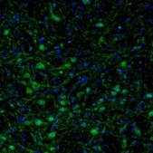 Anti-ARHGAP1 antibody produced in rabbit Prestige Antibodies&#174; Powered by Atlas Antibodies, affinity isolated antibody, buffered aqueous glycerol solution