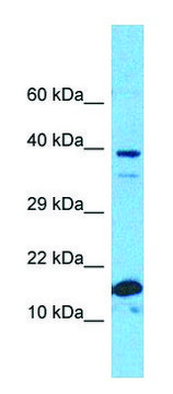 Anti-RPS19 (C-terminal) antibody produced in rabbit affinity isolated antibody
