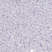 Anti-BCAT2 antibody produced in rabbit Prestige Antibodies&#174; Powered by Atlas Antibodies, affinity isolated antibody, buffered aqueous glycerol solution