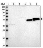 Anti-LPIN1 antibody produced in rabbit Prestige Antibodies&#174; Powered by Atlas Antibodies, affinity isolated antibody, buffered aqueous glycerol solution