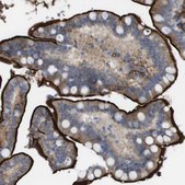 Anti-CYBRD1 antibody produced in rabbit Prestige Antibodies&#174; Powered by Atlas Antibodies, affinity isolated antibody, buffered aqueous glycerol solution