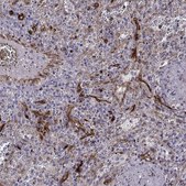 Anti-SLC9A3R2 Prestige Antibodies&#174; Powered by Atlas Antibodies, affinity isolated antibody