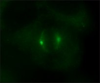 Anti-&#947;-Tubulin (AK-15) antibody produced in rabbit IgG fraction of antiserum, buffered aqueous solution