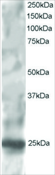 Anti-RGS1/1R20 antibody produced in goat affinity isolated antibody, buffered aqueous solution
