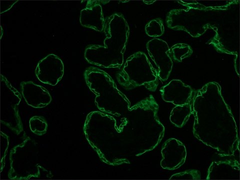 Anti-Cytokeratin pan-FITC antibody, Mouse monoclonal clone PCK-26, purified from hybridoma cell culture