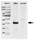 Anti-CDC42 Antibody, Brain Isoform-specific from rabbit, purified by affinity chromatography