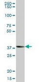Anti-ZSCAN16 antibody produced in mouse purified immunoglobulin, buffered aqueous solution