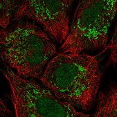 Anti-KCNH3 antibody produced in rabbit Prestige Antibodies&#174; Powered by Atlas Antibodies, affinity isolated antibody, buffered aqueous glycerol solution