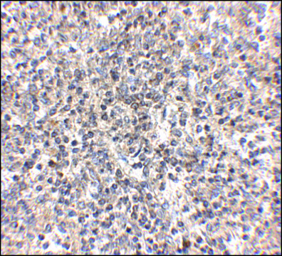 Anti-RSPO1 antibody produced in rabbit affinity isolated antibody, buffered aqueous solution