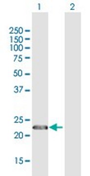 Anti-CENPN antibody produced in rabbit purified immunoglobulin, buffered aqueous solution